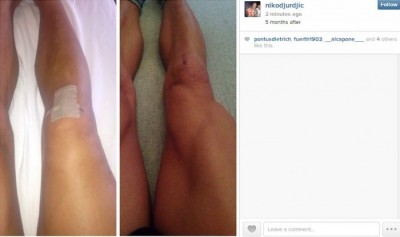 Đurđić jača nogu i broji dane do povratka (FOTO)