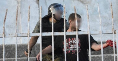 Navijač Vardara ostao bez ruke posle eksplozije bombe (UZNEMIRUJUĆI SNIMAK 18+)