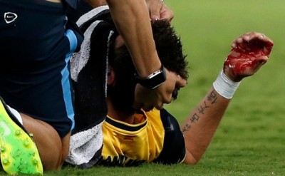 DOBIO PO NOSU: Mandžukić povređen u duelu sa Olimpijakosom