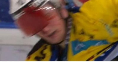 ŽESTOKO IZNABADANJE: Ovo je bilo baš krvavo (VIDEO)