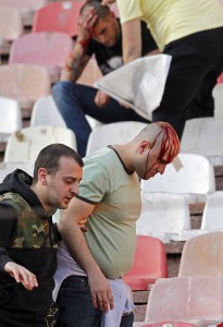 ZAR JE OVO DERBI? Tuče, krv, 0 od fudbala… (FOTOGALERIJA)