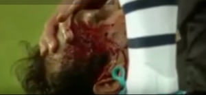 JEZIVO: Evra rasekao glavu Karvalju (VIDEO)