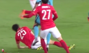 HOROR: Fudbaler Gvanžua doživeo jeziv prelom noge! (VIDEO)