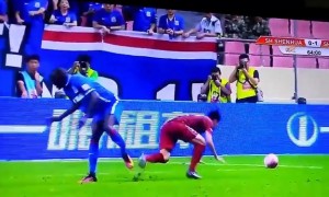 STRAVIČNO: Pogledajte kako na rendgenu izgleda lom noge koji je doživeo Demba Ba (FOTO)