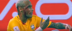 HOROR POVREDA NEJMARA: Hteo da provuče rivalu kroz noge, pa završio obliven krvlju! (VIDEO)