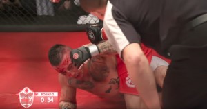 OPET STRADALO OKO: Jeziva povreda srpskog MMA borca (FOTO) (VIDEO)