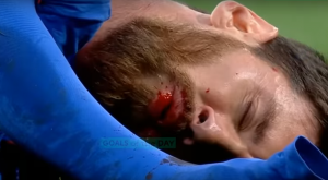 POSLEDICA MARSELOVOG LAKTA: Mesi pljuvao zube u svlačionici ‘Bernabeua’ (VIDEO)