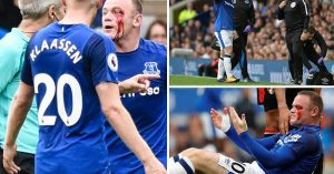 PALA KRV NA ‘GUDISONU’: Stravična povreda Vejna Runija, a nije dobio čak ni faul! (FOTO) (VIDEO)