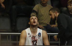 UŽASNA ODLUKA SUDIJE: Mučne slike krvavog Novice Veličkovića koji nije dobio čak ni faul (FOTO)