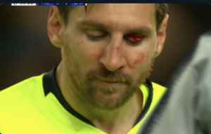 ON ZNA DA TO NISAM NAMERNO URADIO: Smoling se izvino Mesiju!