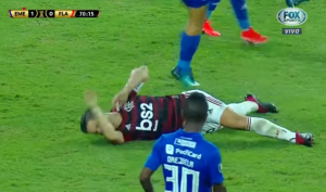 HOROR SCENA: Bivši as Juventusa i Atletiko Madrida doživeo težak prelom noge (VIDEO)