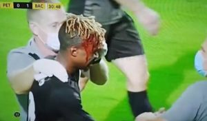 ŽESTOKI ‘SUDAR’ U VAZDUHU: Pogledajte kako je fudbaler TSC-a ‘nokautirao’ protivnika! (VIDEO)