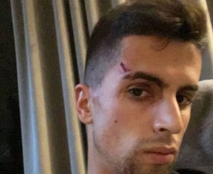 ‘KUKAVICE SU POKUŠALE DA MI POVREDE PORODICU’: Pretučena i opljačkana zvezda Premijer lige! (FOTO)