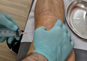 NIJE ZA ONE SA SLABIM STOMAKOM: Ibrahimović je ovim videom zgrozio fanove, pogledajte o čemu se radi! (VIDEO)