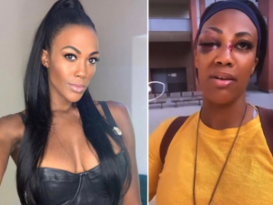 BRUTALAN NAPAD NA KIM GLAS: Jedna od najlepših odojkašica pretučena na ulici u centru grada! (FOTO) (VIDEO)