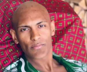 AS BORUSIJE SE BORI SA RAKOM: Isplivala potresna fotografija, napadač neprepoznatljiv posle nekoliko nedelja lečenja! (FOTO)