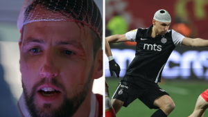 NA DERBIJU „PUCALE GLAVE“, BELIĆ I MILUNOVIĆ NAJGORE PROŠLI: Fudbaler Partizana završio na ušivanju! (FOTO)